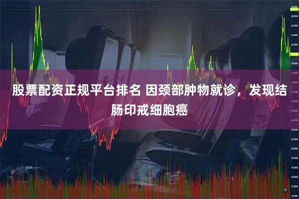 股票配资正规平台排名 因颈部肿物就诊，发现结肠印戒细胞癌